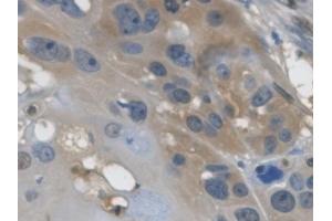 Detection of GAPDH in Human Esophagus Tissue using Monoclonal Antibody to Glyceraldehyde-3-Phosphate Dehydrogenase (GAPDH)