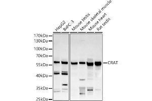 Western blot analysis of extracts of various cell lines, using CRAT antibody (ABIN6131297, ABIN6139003, ABIN6139004 and ABIN6221982) at 1:500 dilution. (CRAT anticorps  (AA 357-626))