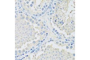 Immunohistochemistry of paraffin-embedded mouse testis using SLC2A9 antibody (ABIN6291466) at dilution of 1:100 (40x lens).