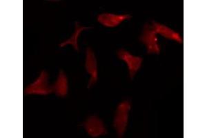 ABIN6275372 staining A549 by IF/ICC.