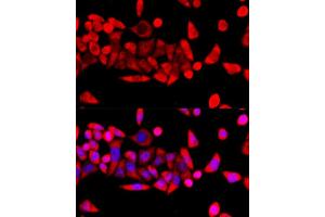 Immunofluorescence analysis of HeLa cells using RPL8 antibody (ABIN6128659, ABIN6147155, ABIN6147156 and ABIN6214154) at dilution of 1:100 (40x lens).