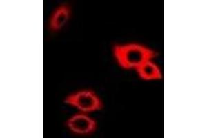 Immunofluorescent analysis of Alpha-galactosidase A staining in Hela cells. (GLA anticorps)