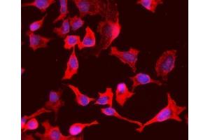 IF analysis of PCK1/PEPC using anti-PCK1/PEPC antibody (ABIN7599502). (PCK1 anticorps  (AA 1-622))