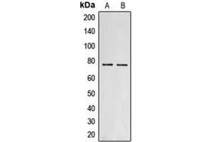 Western blot analysis of Collagen 18 alpha 1 expression in MCF7 (A), PC12 (B) whole cell lysates. (COL18A1 anticorps  (C-Term))