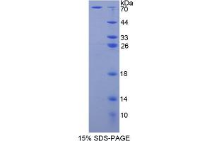 Image no. 1 for Adenosine Kinase (ADK) (AA 1-361) protein (His tag,GST tag) (ABIN6237780) (ADK Protein (AA 1-361) (His tag,GST tag))