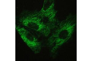IHC analysis of ATX2 using anti-ATX2 antibody .