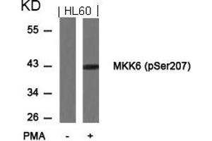 Western blot analysis of extracts from HL60 cells untreated or treated with PMA using MKK6(Phospho-Ser207) Antibody. (MAP2K6 anticorps  (pSer207))