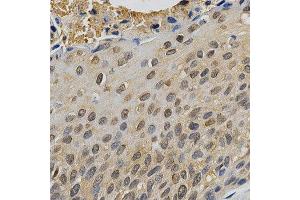 Immunohistochemistry (IHC) image for anti-Mitogen-Activated Protein Kinase 10 (MAPK10) (AA 175-464) antibody (ABIN3022948)