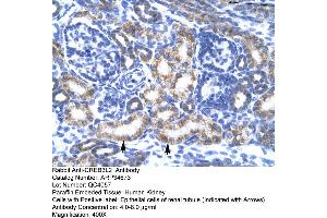 Human kidney (CREB3L2 anticorps  (N-Term))