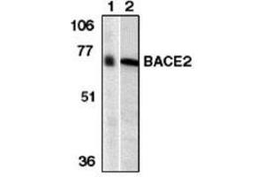 Image no. 1 for anti-beta-Site APP-Cleaving Enzyme 2 (BACE2) (AA 44-59) antibody (ABIN264996) (BACE2 anticorps  (AA 44-59))