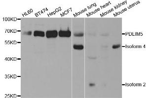 Western blot analysis of extracts of various cell lines, using PDLIM5 antibody (ABIN5973350) at 1/1000 dilution. (PDLIM5 anticorps)