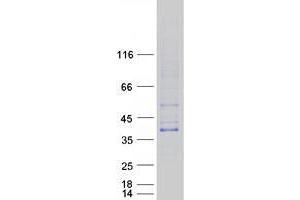 Validation with Western Blot