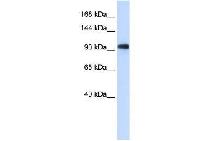 EXOSC10 antibody used at 1 ug/ml to detect target protein. (EXOSC10 anticorps  (Middle Region))