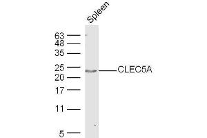 Mouse spleen lysates probed with Rabbit Anti-CLEC5A Polyclonal Antibody, Unconjugated  at 1:500 for 90 min at 37˚C. (CLEC5A anticorps  (AA 101-190))