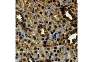 Immunohistochemical analysis of EYA3 staining in rat kidney formalin fixed paraffin embedded tissue section. (EYA3 anticorps)