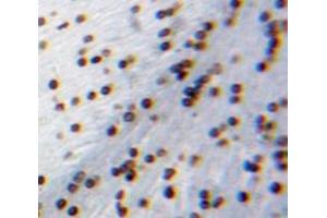 IHC-P analysis of Brain tissue, with DAB staining. (CIDEA anticorps  (AA 1-219))