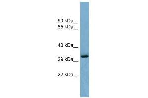 OTUD6B antibody used at 1 ug/ml to detect target protein. (OTUD6B anticorps  (Middle Region))