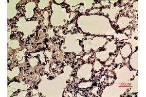 Immunohistochemical analysis of paraffin-embedded rat-lung, antibody was diluted at 1:100. (NRF2 anticorps  (acLys599))