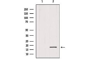 Western blot analysis of extracts from 293, using SKP1 Antibody. (SKP1 anticorps  (Internal Region))