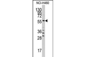 Western blot analysis of anti-SARS Antibody (C-term) (ABIN392296 and ABIN2841952) in NCI- cell line lysates (35 μg/lane). (Seryl-tRNA Synthetase (SARS) (AA 394-422), (C-Term) anticorps)