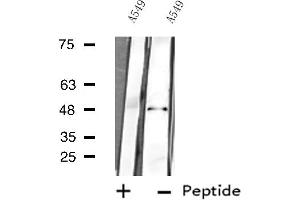 Western blot analysis of extracts from A549 cells using MAPK9 antibody. (JNK2 anticorps  (N-Term))