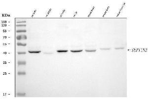 Western blot analysis of Septin 2/SEPTIN2 using anti-Septin 2/SEPTIN2 antibody (ABIN7599275). (Septin 2 anticorps  (AA 1-326))