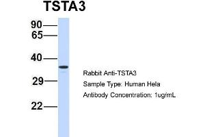 Host: Rabbit Target Name: TSTA3 Sample Type: Hela Antibody Dilution: 1. (TSTA3 anticorps  (N-Term))