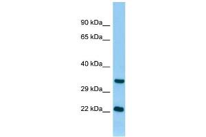 WB Suggested Anti-Tnni3 Antibody Titration: 1. (TNNI3 anticorps  (N-Term))