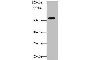 Western blot All lanes: ICA1L antibody at 1. (ICA1L anticorps  (AA 1-187))
