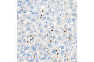 Immunohistochemistry of paraffin embedded mouse liver+LPS using ly6g (ABIN7074524) at dilution of 1:800 (400x lens) (Ly6g anticorps)