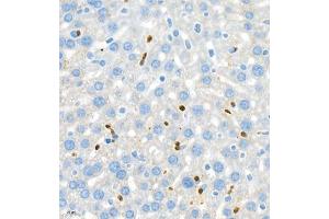 Immunohistochemistry (Paraffin-embedded Sections) (IHC (p)) image for anti-Lymphocyte Antigen 6 Complex, Locus G (Ly6g) antibody (ABIN7074524)