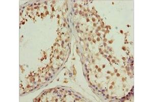 Immunohistochemistry of paraffin-embedded human testis tissue using ABIN7157772 at dilution of 1:100 (L2HGDH anticorps  (AA 1-220))