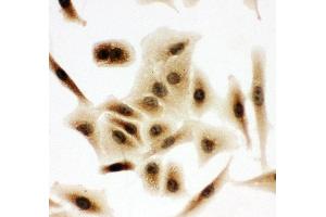 Anti-Bub3 antibody, ICC ICC: A549 Cell