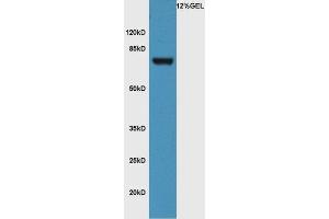 Lane 1: mouse pancreas lysate probed with Rabbit Anti-FZD3/Frizzled 3 Polyclonal Antibody, Unconjugated (ABIN1714171) at 1:300 overnight at 4 °C.