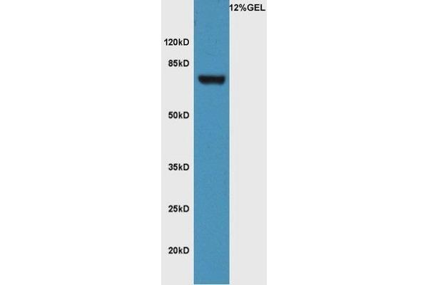 FZD3 anticorps  (AA 121-220)