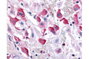 Anti-BRS3 antibody IHC of human uterus, pregnant. (BRS3 anticorps  (Cytoplasmic Domain))