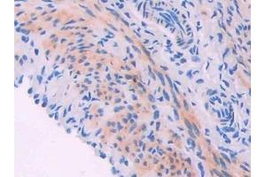 Detection of MYLK in Mouse Oviduct Tissue using Polyclonal Antibody to Myosin Light Chain Kinase (MYLK) (MYLK anticorps  (AA 1684-1884))