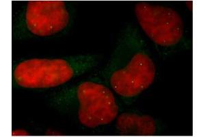 Image no. 2 for anti-Survival of Motor Neuron 1, Telomeric (SMN1) antibody (ABIN108566) (SMN1 anticorps)