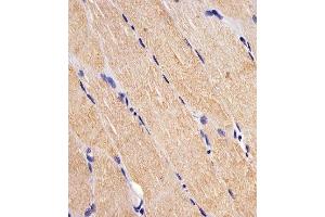 Paraformaldehyde-fixed, paraffin embedded human skeletal muscle, Antigen retrieval by boiling in sodium citrate buffer (pH6.
