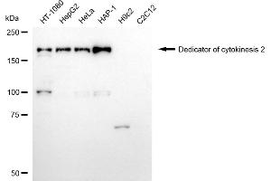 Western blotting analysis using dedicator of cytokinesis 2 antibody (ABIN7798300).