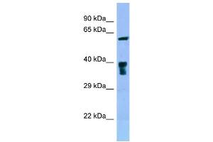 WB Suggested Anti-SLC22A5 Antibody Titration: 1. (SLC22A5 anticorps  (C-Term))
