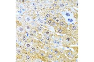 Immunohistochemistry of paraffin-embedded mouse liver using CCND1 antibody. (Cyclin D1 anticorps  (C-Term))
