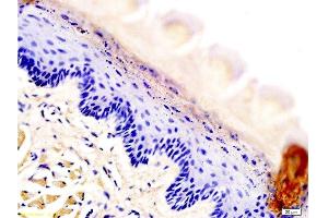 Formalin-fixed and rat tongue tissue labeled with Anti-AQP-3 Polyclonal Antibody, Unconjugated at 1:200 followed by conjugation to the secondary antibody and DAB staining (AQP3 anticorps  (AA 201-292))