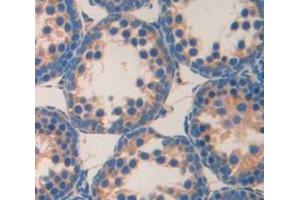 Used in DAB staining on fromalin fixed paraffin- embedded testis tissue (MAST2 anticorps  (AA 512-785))