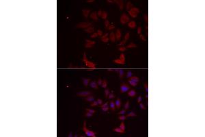 Immunofluorescence analysis of MCF-7 cells using RPL11 antibody. (RPL11 anticorps)