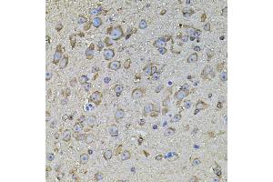 Immunohistochemistry of paraffin-embedded mouse brain using CPOX antibody (ABIN5971997) at dilution of 1/100 (40x lens). (CPOX anticorps)