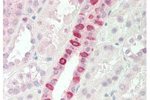 Rabbit Anti-RBM5 antibody  Formalin Fixed Paraffin Embedded Tissue: Human Kidney Primary antibody Concentration: 1:100 Secondary Antibody: Donkey anti-Rabbit-Cy3 Secondary Antibody Concentration: 1:200 Magnification: 20x Exposure Time: 0.