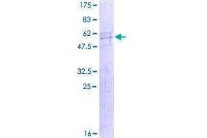 Image no. 1 for Spermatogenesis Associated 9 (SPATA9) (AA 1-254) protein (GST tag) (ABIN1321114)