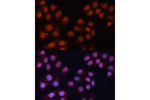 Immunofluorescence analysis of HeLa cells using CDK11B antibody (ABIN6130092, ABIN6138305, ABIN6138306 and ABIN6216598) at dilution of 1:100.