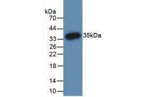 Western blot analysis of recombinant Human PADI3. (PADI3 anticorps  (AA 1-300))